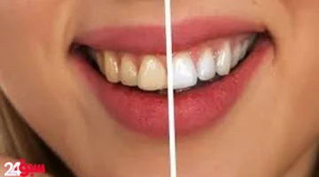 اصفرار الأسنان: وداعاً له بثلاث طرق طبيعية بسيطة من داخل مطبخك